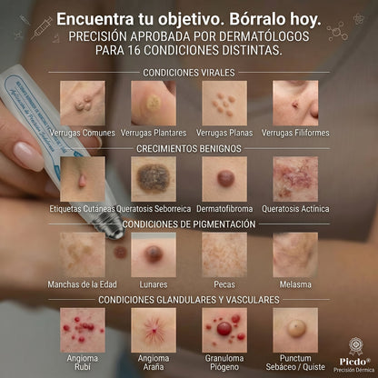 🔥🎁 ¡ÚLTIMAS 5 UNIDADES! Aprovecha un 30% DE DESCUENTO adicional en 𝐏𝐢𝐜𝐝𝐨® Borrador de Verrugas y Manchas — ¡Hasta que dure el stock!