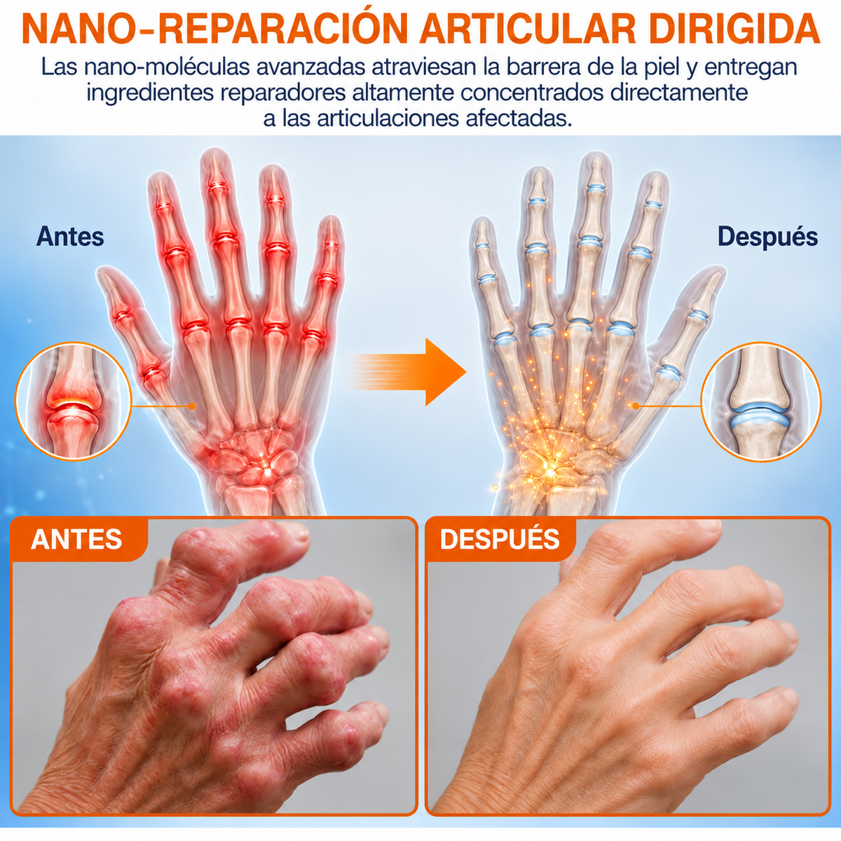 💌👨‍⚕️✅Tienda oficial ES: Parche de microagujas Healrize® para el alivio del dolor y la curación ósea (🧑‍⚕️Reduce la hinchazón, el dolor, la rigidez, el enrojecimiento, el calor, las molestias y la fatiga articular)💖📌3